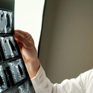 Typische Krankheiten für eine Berufsgruppe