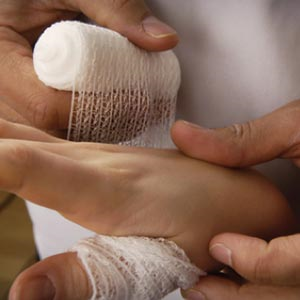 Unfälle mit weniger als 3 Tagen Arbeitsausfall